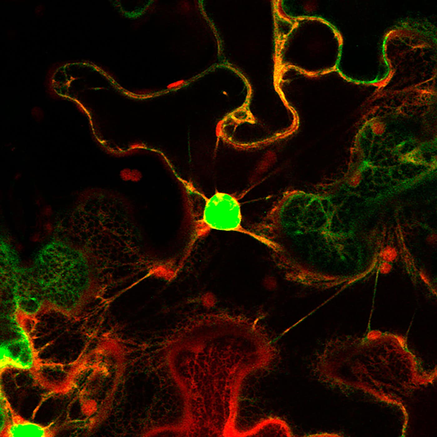 Communicating the language of plants through inositol phosphates ...