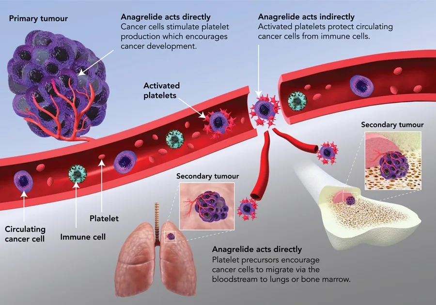 Cancer Development Process Diagram
