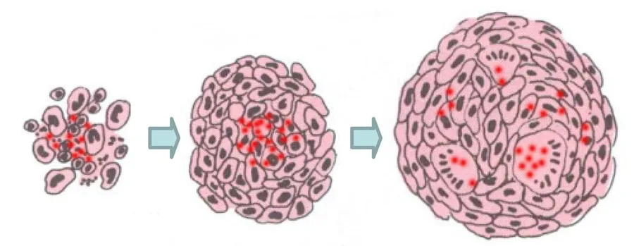 Shining a light on sarcoidosis: The path from infection to treatment