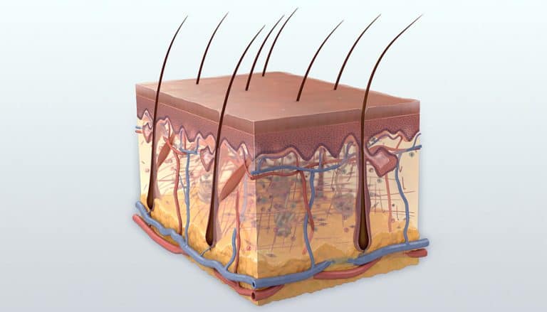 Brazen Skin Example New therapy offers hope for wound healing in severely burned patients ...