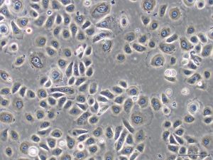 keratinocyte cell