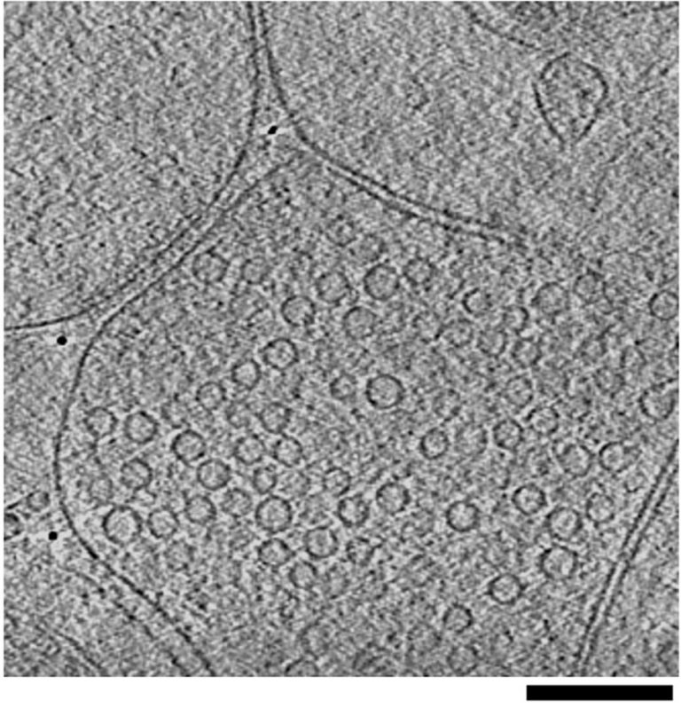 Cryo-electron Tomography And Synaptic Transmission In The Brain ...