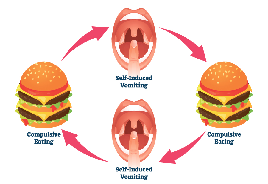 just-bingeing-or-bingeing-and-purging-differences-and-myths-eating