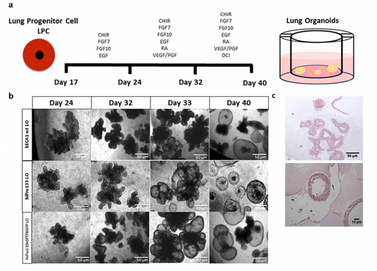 Laboratory lungs: The implications of lung organoids for health and ...