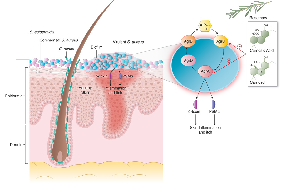 Staphylococcus aureus: A new mechanism involv